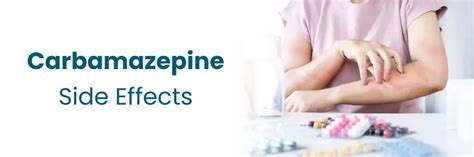 Infografica sugli effetti collaterali comuni della carbamazepina