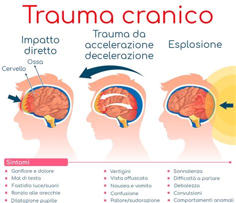 Infografica che illustra le aree cognitive colpite da un trauma cranico lieve: attenzione, memoria, funzioni esecutive