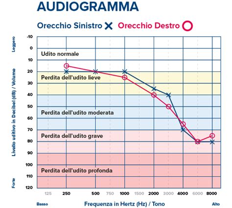 Grafico sull'incidenza della perdita uditiva per età