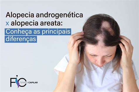 Confronto visivo tra alopecia androgenetica e alopecia da stress