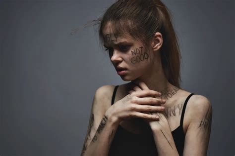 Ragazza con segni di anoressia