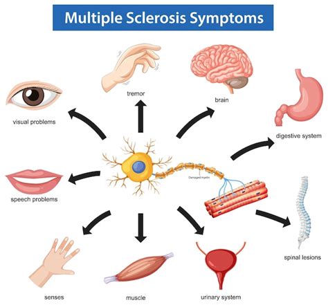 Diagramma che illustra la sovrapposizione dei sintomi in adolescenza