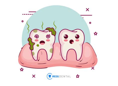 Diagramma che illustra i danni ai denti causati dall'acido gastrico