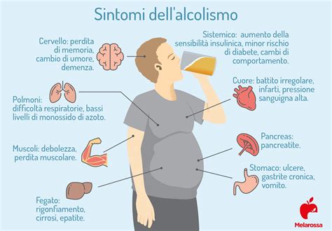 Diagramma che mostra la progressione dei sintomi dell'astinenza da alcol, dall'allucinosi al delirium tremens