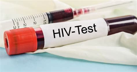 Grafico che illustra il periodo finestra dei test HIV