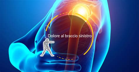 Infografica che illustra le diverse cause di dolore al braccio, distinguendo tra muscolari, nervose e articolari