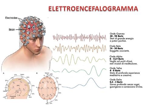 Diagramma del funzionamento di un elettroencefalogramma (EEG)