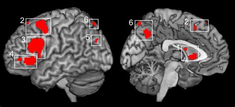 Schema che illustra le diverse tecniche di neuroimaging e le loro applicazioni