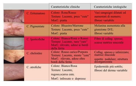 Schema delle diverse tipologie di cicatrici chirurgiche al seno