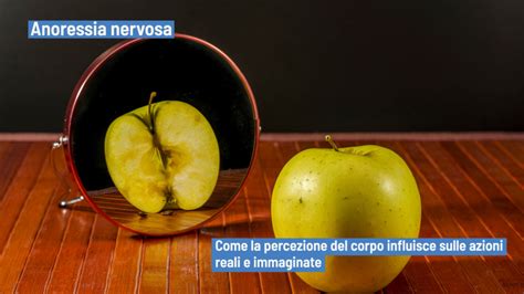 Diagramma che illustra i diversi fattori che contribuiscono all'anoressia nervosa