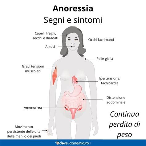 Infografica che mostra i sintomi principali dell'anoressia nervosa