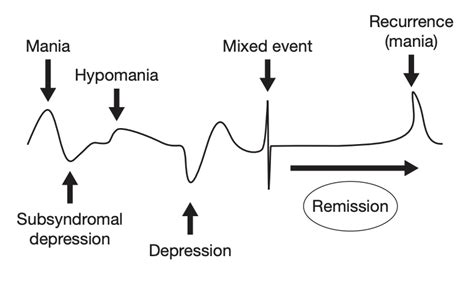 Grafico che mostra la prevalenza degli episodi depressivi rispetto a quelli maniacali nel disturbo bipolare