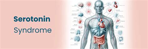 Infografica che evidenzia i sintomi della sindrome serotoninergica e le misure di primo intervento