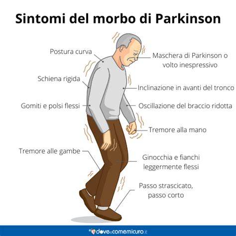 Illustrazione che mostra la complessità dei sintomi associati alla malattia di Parkinson, inclusi quelli motori e non motori