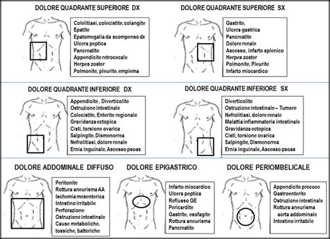 Schema che illustra le diverse possibili cause di dolore addominale