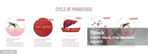 Infografica sul ciclo tensione-sollievo nella tricotillomania