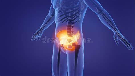 Illustrazione che mostra le diverse aree di dolore pelvico