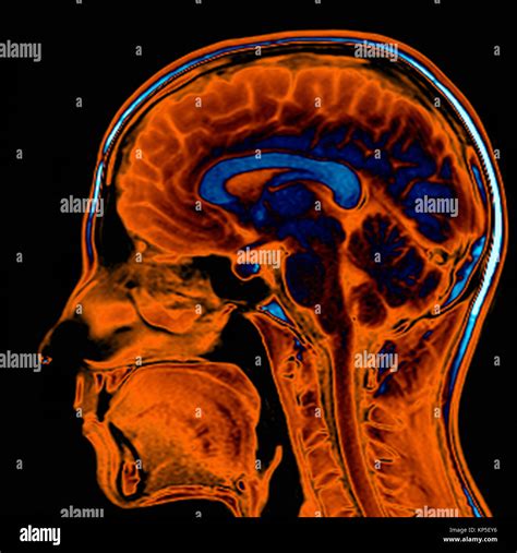 Immagine che mostra una scansione fMRI del cervello umano durante un'attività cognitiva, evidenziando le aree attive.