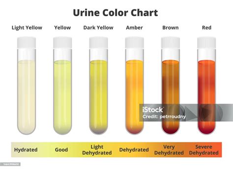 Schema del test da carico delle urine con agente chelante