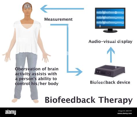 Schema di funzionamento del biofeedback