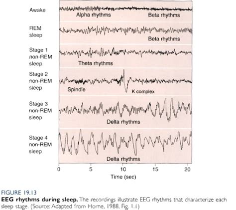 Grafico comparativo degli stadi del sonno indotti da benzodiazepine e zolpidem