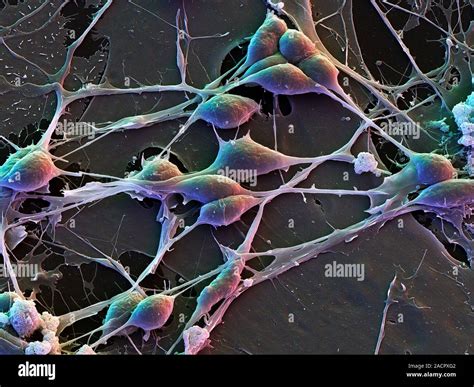 Microscopio elettronico che mostra neuroni
