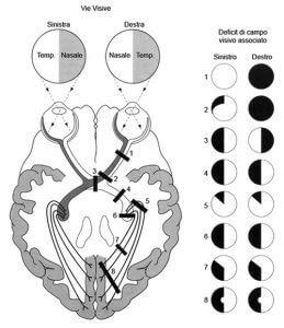 Schema di un test visivo per la percezione del movimento