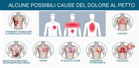 illustrazione di diversi tipi di dolore al petto