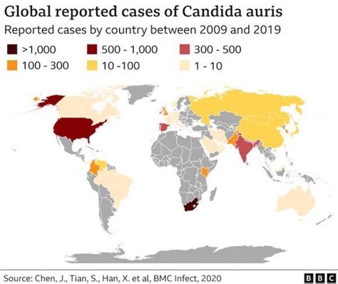 Mappa che illustra la diffusione globale di Candida auris
