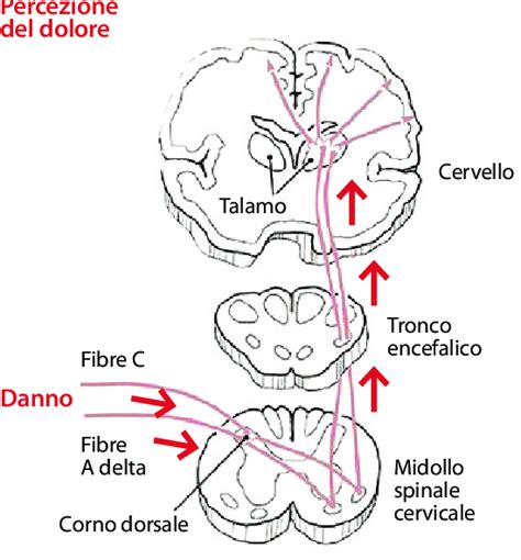 Diagramma che illustra la via del dolore dal periferico al centrale
