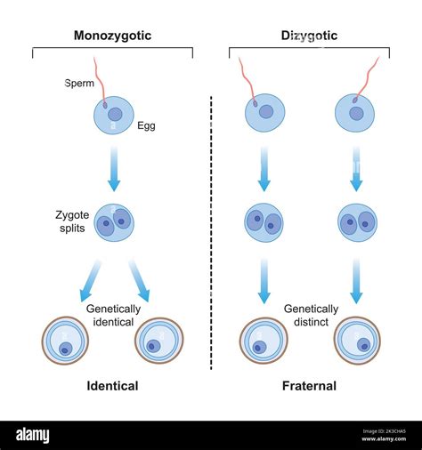 Infografica che illustra la differenza di concordanza dell'autismo tra gemelli monozigoti e dizigoti
