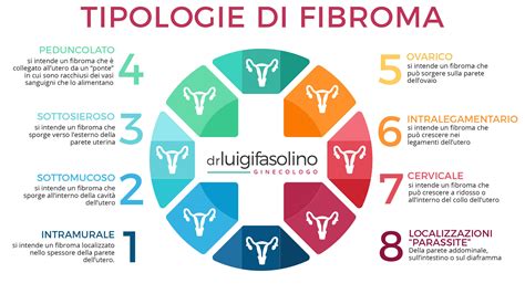 Infografica sui sintomi dei fibromi uterini