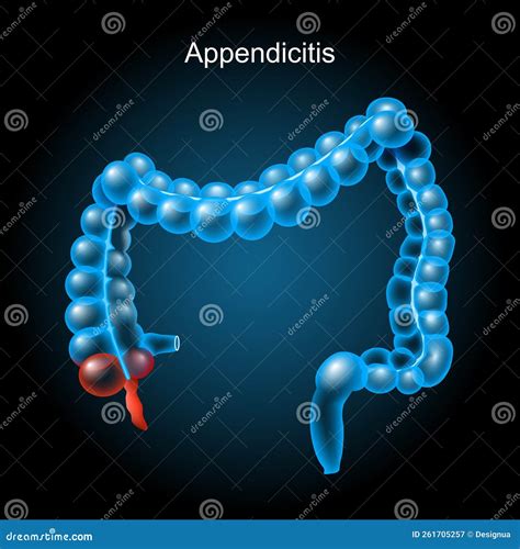 Anatomia dell'appendice umana