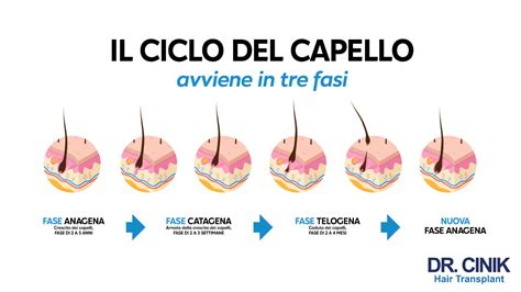 Infografica sulle diverse cause della perdita di capelli