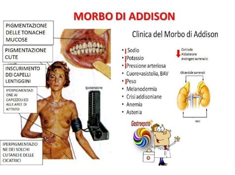 Schema riassuntivo dei principali sintomi, diagnosi e trattamenti per la Malattia di Addison.