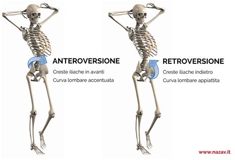 Diagramma che illustra la retroversione e anteroversione del bacino