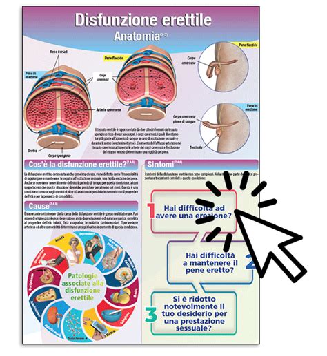 Grafico che mostra la correlazione tra sintomi e diagnosi
