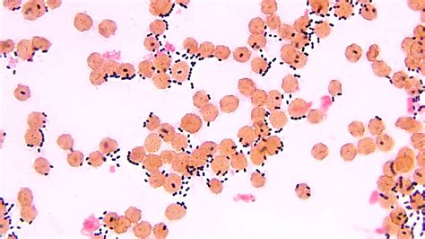 Micrografia di Streptococcus pneumoniae che mostra i caratteristici diplococchi.